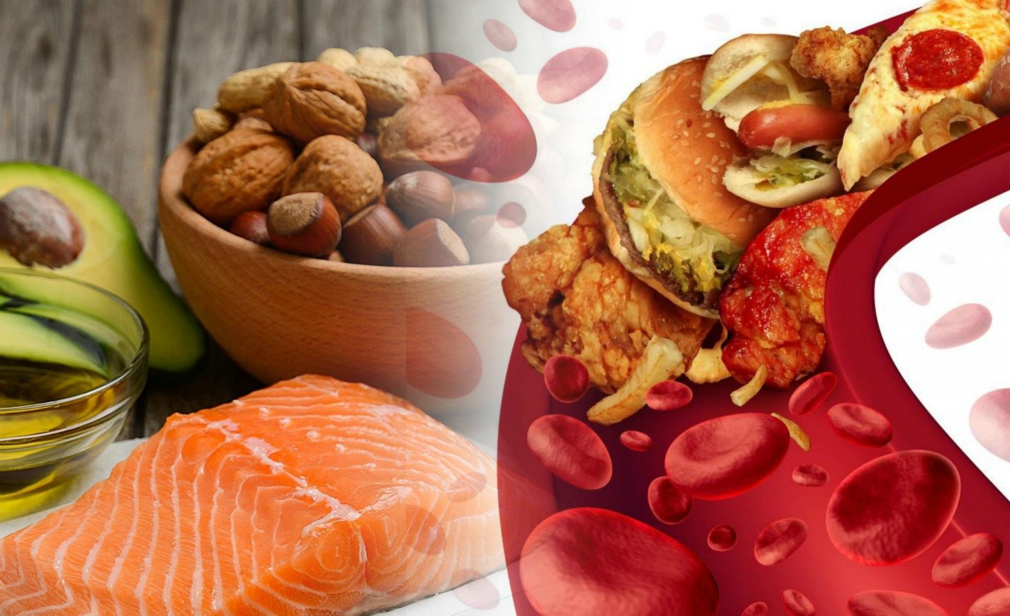 ВЫСОКИЙ ХОЛЕСТЕРИН: СНИЗИТЬ НЕЛЬЗЯ ПОВЫСИТЬ